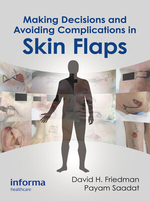 cover image of Making Decisions and Avoiding Complications in Skin Flaps